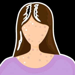 Nigeria Records 17 New Monkeypox Cases In 12 States