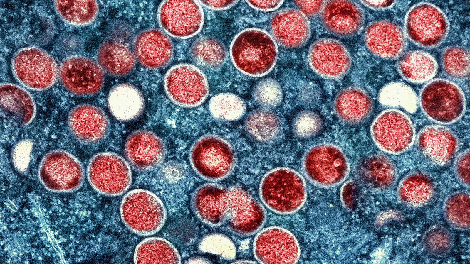 Mpox: UK preparing after virus declared global emergency - as Sweden records first case