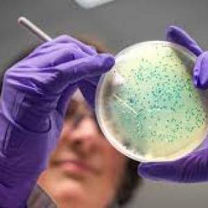 disease-causing-salmonella-could-help-combat-bowel-cancer-study-suggests